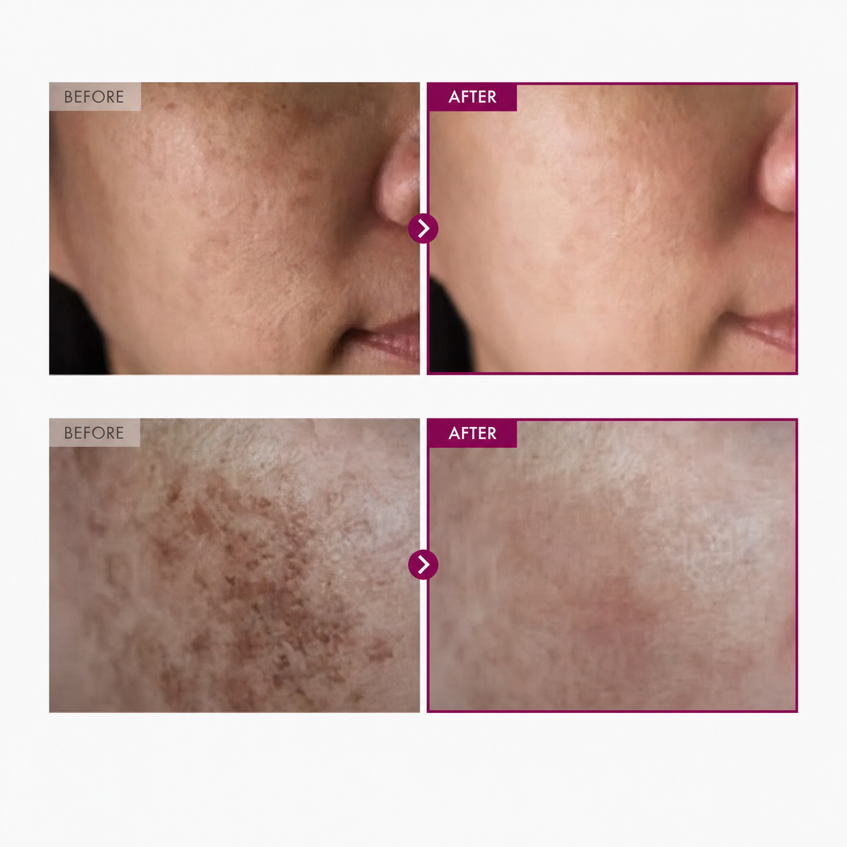Korean Arbutin Brightening Cream